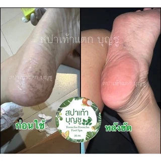 สปาขัดเท้าแตก สปาเท้าบุญชู(อุปกรณ์ครบใน1ชุด)ขัดส้นเท้าแตก เห็นผลตั้งแต่ครั้งแรกที่ใช้ ของแท้ 100% (คลิกดูรีวิว)