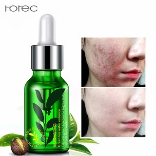 เซรั่ม ชาเขียว Rorec green tea water essence เซรั่ม ลดเลือนริ้วรอยแห่งวัย รอยสิว รอยแดง รอยดำ ลดความหมองคล้ำ 15 ml.