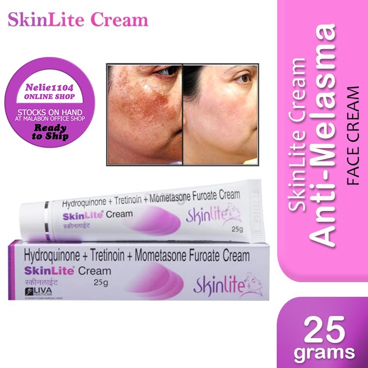 ครีมทาฝ้า ลดฝ้า ลดกระ ลดรอยดำ จากอินเดีย Skinshine Skinlite สกินไลต์ สกินไลท์ 25g