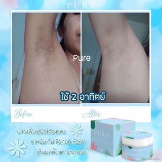 ✓♕ครีม เพียว Pure underarm ครีมเพียวรักแร้ขาว 50 g.รักแร้ดำ ดำตรงไหนทาตรงนั้นแท้100%