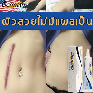 ของแท้ 100%Dermatix Ultra 15g ครีมลบแผลเป็น เจลซ่อมแซม เจลลบรอยแผลเป็น ลบรอยแผลเป็น แผลผ่าตัด น้ำร้อนลวก