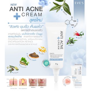 ครีมแต้มสิวอีฟส์ EVES ANTI ACNE CREAM ขนาด 9 กรัม