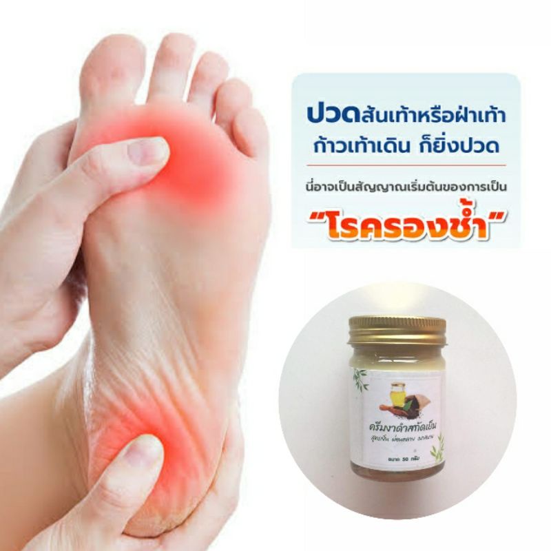 ครีมงาดำสกัดเย็นปวดส้นเท้า รองช้ำ