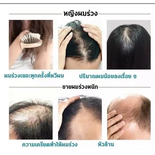 ของแท้100%🌱 500 ML บํารุงผม แชมพูแก้ผมร่วง แชมพูขิงเพียว บำรุงหนังศรีษะ 🌱