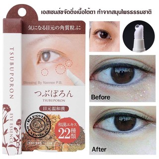 Tsubuporon  Eye  Essence 1.8ml. ยาแต้มขจัดติ่งเนื้อ สำหรับผู้ที่มีติ่งเนื้อบริเวณใต้ตาและบนใบหน้า