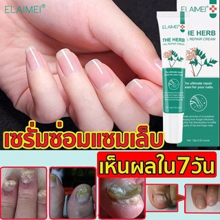 ELAIMEI ครีมซ่อมเล็บ ดูแลเล็บ ซ่อมแซมเล็บ บำรุงเล็บ Nail Repair Essence（รักษาเล็บ, เล็บหนา ซ่อมแซมเล็บ,ที่ตัดเล็บขบ เล็บแตก น้ำมันบำรุงเล็บ น้ำยารักษาเล็บ รักษาเล็บขบ เล็บเปราะ เล็บไม่เรียบ）