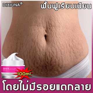 DIXIUYA ครีมแก้ท้องลาย 100g ลดริ้วรอยการตั้งครรภ์อย่างรวดเร็ว ครีมลดลอยเเตก ครีมลดรอยแตก ครีมทาท้องลาย ครีมทาแตกลาย