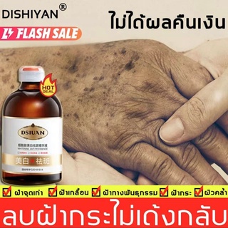 DISHIYAN ครีมทาฝ้า 100m ครีมถาหน้าขาว ครีมทาฝ้าหนาๆ ช่วยกำจัดฝ้ากระ / จุดดำ /ฝ้าถูกแดดเผาอย่างเป็นมืออาชีพ ทำให้ผิวขาวกร