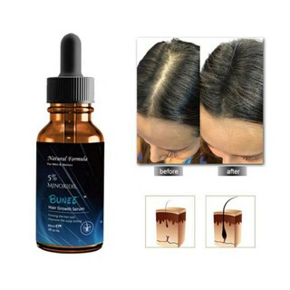 Bunee hair growth Serum เซรั่มบำรุงหนังศรีษะปลูกเส้นผมใหม่