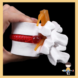 *❤❤Human Anatomical Lumbar Disc Herniation Model