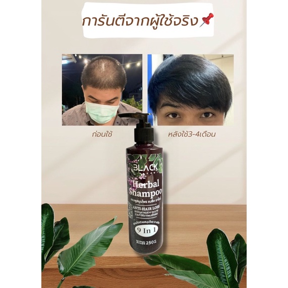 Black shadow herbal shampoo แชมพูลดผมร่วงผมบางหนังศีรษะล้านลดผมมันขจัด ...