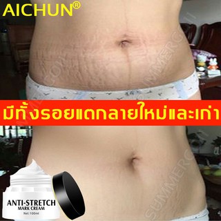 AICHUNครีมลดรอยแตก จางลงรอยแตกลาย ครีมทาท้องแตกลาย ครีมทารอยแตกลาย ครีมลดรอยแตกลาย ครีมทาท้องแตกลาย ครีมรอยแตกลาย