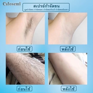 ครีมกำจัดขนCalosemi ❤️ สเปรย์มูสกำจัดขน ขนาด150ml สเปรย์กำจัด กำจัดขนรักแร้ กำจัดขนแขน กำจัดขนขา