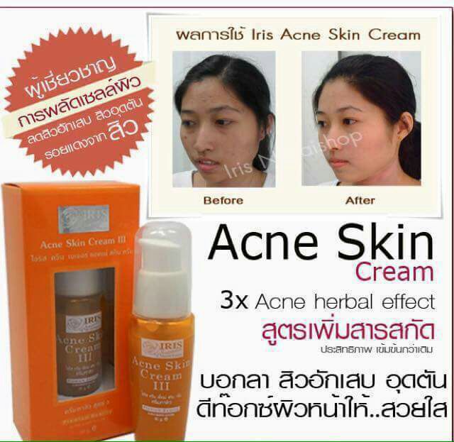 (ครีมสิว) ไอริส ควีน เนเจอร์ สั่งซื้อในวีดีโอร้านมีส่วนลด25%ค่ะ ราคา ถูกที่สุด ดีลบีเคเค แกลเลอรีภาพที่ 5
