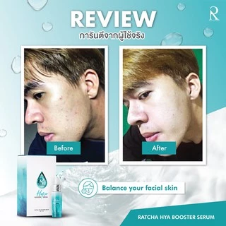 Ratcha Hya Booster Serum เซรั่มไฮยา บูสเตอร์ By น้องฉัตร (15 ml. x 1 กล่อง)