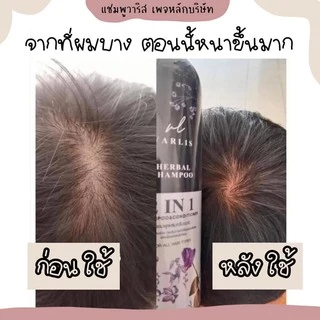 แชมพูวาริส 2in 1 ( Varlis Shampoo Baimee And Butterfly Shampoo 400 ml.)