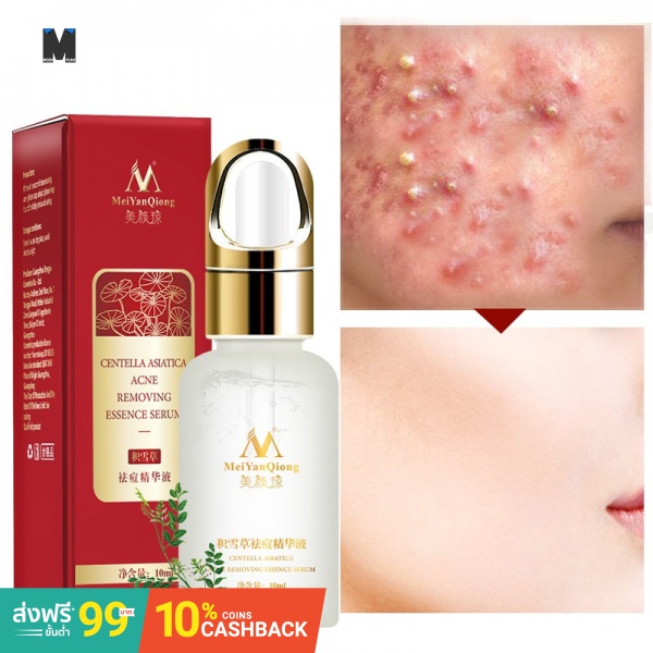 serum to lighten acne scars