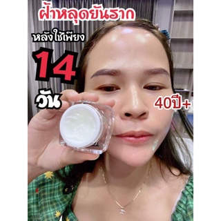 ครีมทาฝ้ามายาของแท้💯%💦 เซรั่มโบท็อกหน้าตึง ลดฝ้ากระจุดด่างดำบนใบหน้า