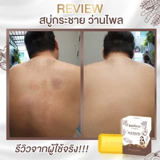 สบู่กระชายว่านไพล กำจัดติ่งเนื้อ ฝ้ากระ คอดำ ใบหน้าคล้ำ แก้ปัญหา กลาก เกลื้อน เชื้อรา สะเก็ดเงิน สิวที่หน้า สิวที่หลัง