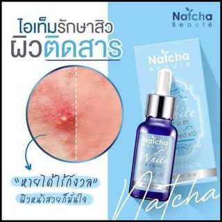 Natcha เซรั่มนัชชา สลายฝ้า หน้าขาวใสลดสิว