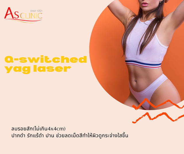 q switched yag laserลบรอยสัก/ปากดำ/รักแร้ดำ/ปาน