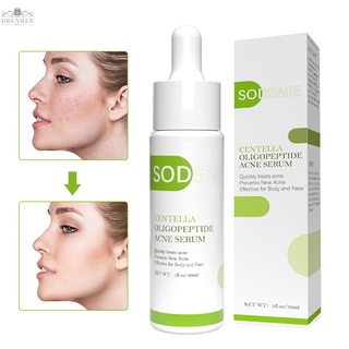 Dreamer SODSNIE Centella Asiatica Oligopeptide เซรั่มบํารุงผิวหน้า ไวท์เทนนิ่ง ให้ความชุ่มชื้น ควบคุมความมัน กระชับรูขุมขน กําจัดสิวเสี้ยน