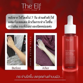 โดสแดง นาโนไวท์โดส The Elf Nano White Dose 60 ml.❤️