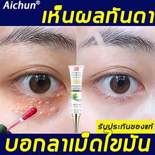 Aichun ครีมบำรุงรอบดวงตา 30ml ขมันและฟื้นฟูผิวรอบดวงตา ครีมใต้ตา เซรั่มทาถุงใต้ตา ครีมแก้ขอบตาดำ าดำครีมทารอบดวงตา