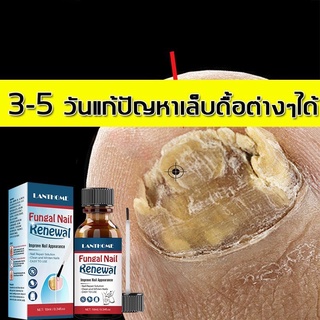 SimpleLife เซรั่มบำรุงเล็บ เล็บเจล  น้ํายากันเชื้อราเล็บ บำรุงเล็บเจลบํารุงเล็บ ยาหยอดเล็บเชื้อรา ครีมบำรุงเล็บ C09