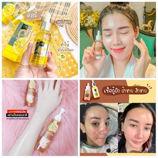 เซรั่ม มะหาด ผิวขาวกระจ่างใส mahad facial serum skin serum lemon peel bio ferment mahad  body serum เซรั่ม chy hoyonna