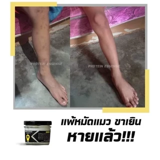Ers ตัวเร่งลดรอยดำติดสปีด