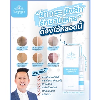 ถูกที่สุด⚡️ฝ้ากระฝังลึกรักษาไม่หายต้องหลอดนี้⚡️ครีมสลายฝ้า "Nangngam Anti-Melasma &amp; Dark Spot Cream