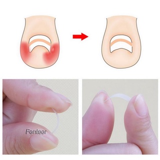 [FENTEER] 10Pcs Ingrown Toenail Straightening Clip Toenails Correction Patch Pedicure