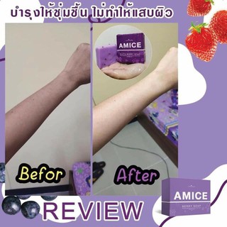 เอมิส สบู่ผิวเผือก AMICE