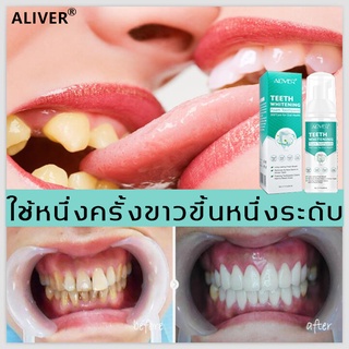 พร้อมส่งแบบด่วน😁ALIVERมูสแปรงฟัน60mlฟอกฟันขาวขจัดคราบหินปูน ยาสีฟันไวท์เทนนิ่งยาสีฟันฟันขาวการฟอกสีฟันฟอกสีฟัน ดูแลฟัน