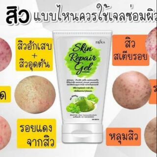 เจลซ่อมผิว erjka  skin repair gel