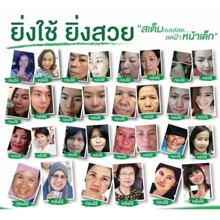 [ไม่เห็นผลยินดีคืนเงิน💯] ครีมรักษาฝ้า สารสกัดจากธรรมชาติ ครีมทาฝ้า ครีมลาชูเล่ lachule