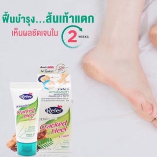 (ล็อตใหม่สุด 9/8/24) Refer Whitening [&gt;Cracked Heel กล่องเขียว&lt;] Cream 50 g ช่วยฟื้นบำรุงผิว ส้นเท้าแตก