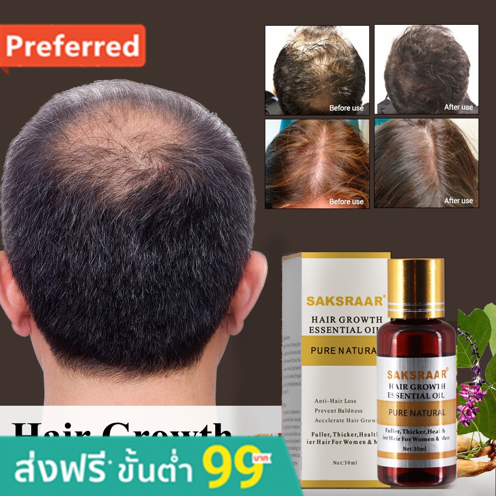 Hair Care Hair Growth Essential Oils Essence Original Authentic 100% Hair  Loss Liquid Health Care Beauty Dense Hair Grow | Shopee Thailand