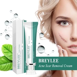 BREYLEE ครีมสมุนไพร ลบรอยแผลเป็นจากสิว แผลผ่าตัด และแผลไฟไหม้ สูตรสมุนไพร ฟื้นฟูผิวให้เรียบเนียน จางลงอย่างเป็นธรรมชาติ remove scar