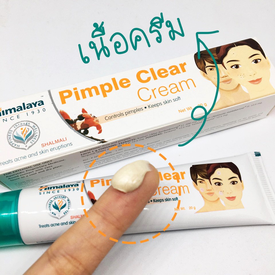 Himalaya Pimple Clear Cream (20g.) 🇮🇳 ครีมแต้มสิว