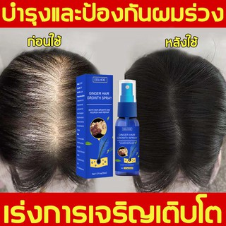 ผมขึ้นเร็ว！ EELHOE สเปรย์ปลูกผม30ml ส่งเสริมการเจริญเติบโตเส้นผม ลดผมร่วง(เซรั่มปลูกผม ป้องกันผมร่วง น้ำยาปลูกผม)