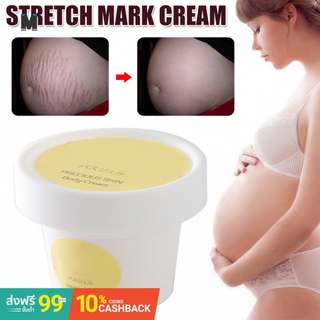 postpartum stretch mark cream