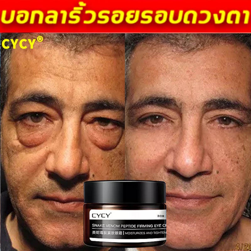 สินค้านำเข้า ถุงใต้ตา รอยตีนกา,ครีมลดถุงใต้ตา อายครีม