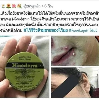Nixoderm ครีมรักษาสิว สิว สิวอักเสบ สิวอุดตัน สิวผด ผื่น กลากเกลื้อน อาการคัน เชื้อรา บรรเทาอาการคันตามผิวหนัง ผลิต07/21