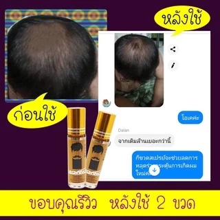 ลีกาโน่ เซรั่ม ปลูกคิ้ว ปลูกหนวด ปลูกไรผม ปลูกผม หลุดการขาดร่วง บำรุงให้ดกดำ 10มล.