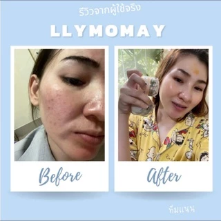 [โค้ดส่วนลดในไลฟ์] ไนท์ครีมบำรุง ขนาด10g. หน้าขาวใสลดสิวฝ้ากระ ครีมเอลลี่โมเม ผลิตภัณฑ์บำรุงผิวหน้า