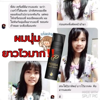 C Perra หัวเชื้อ เร่งผมยาว ปลูกผม ผมร่วง หัวล้าน ปลูกหนวด ราคาถูก เห็นผล แท้ มี อย ปลอดภัย เร่งด่วน