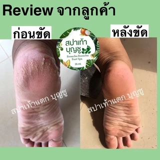 สปาขัดเท้าแตก สปาเท้าบุญชู(อุปกรณ์ครบใน1ชุด)ขัดส้นเท้าแตก เห็นผลตั้งแต่ครั้งแรกที่ใช้ ของแท้ 100% (คลิกดูรีวิว)