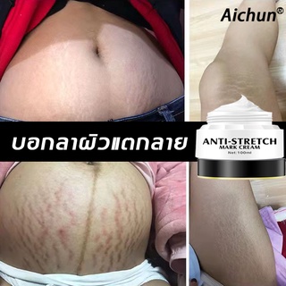 Aichunครีมท้องแตกลาย 100ml ลบรอยแตกลายได้อย่างมีประสิทธิภา  ครีมทารอยแตกลาย ครีมซ่อมแซมรอยแตกลาย สเตรทช์มาร์คเซรั่ม